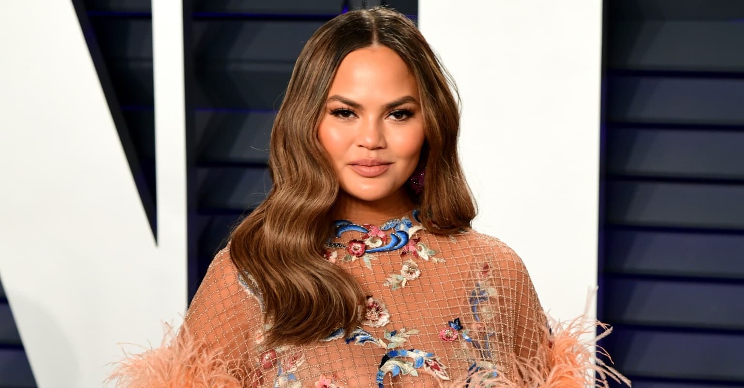 Chrissy Teigen shocks fans as she reveals swollen lips and nose after allergic reaction