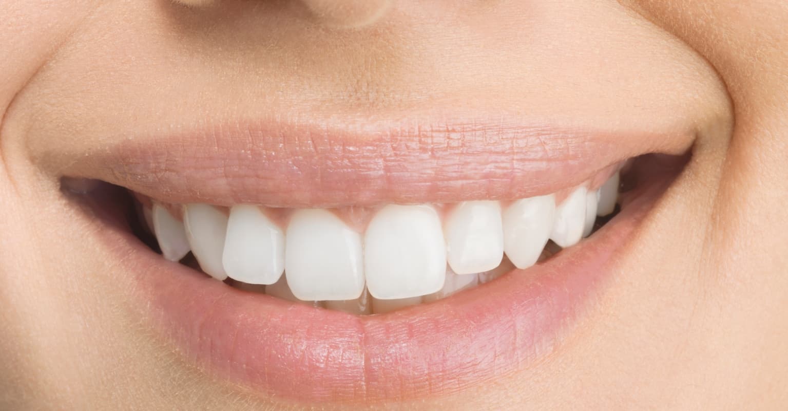 Woman who had all her teeth pulled out finally receives brand new beautiful smile