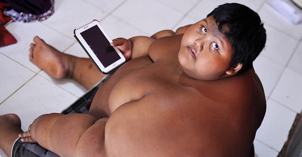 Former 'world's fattest boy' is unrecognizable after losing half his bodyweight