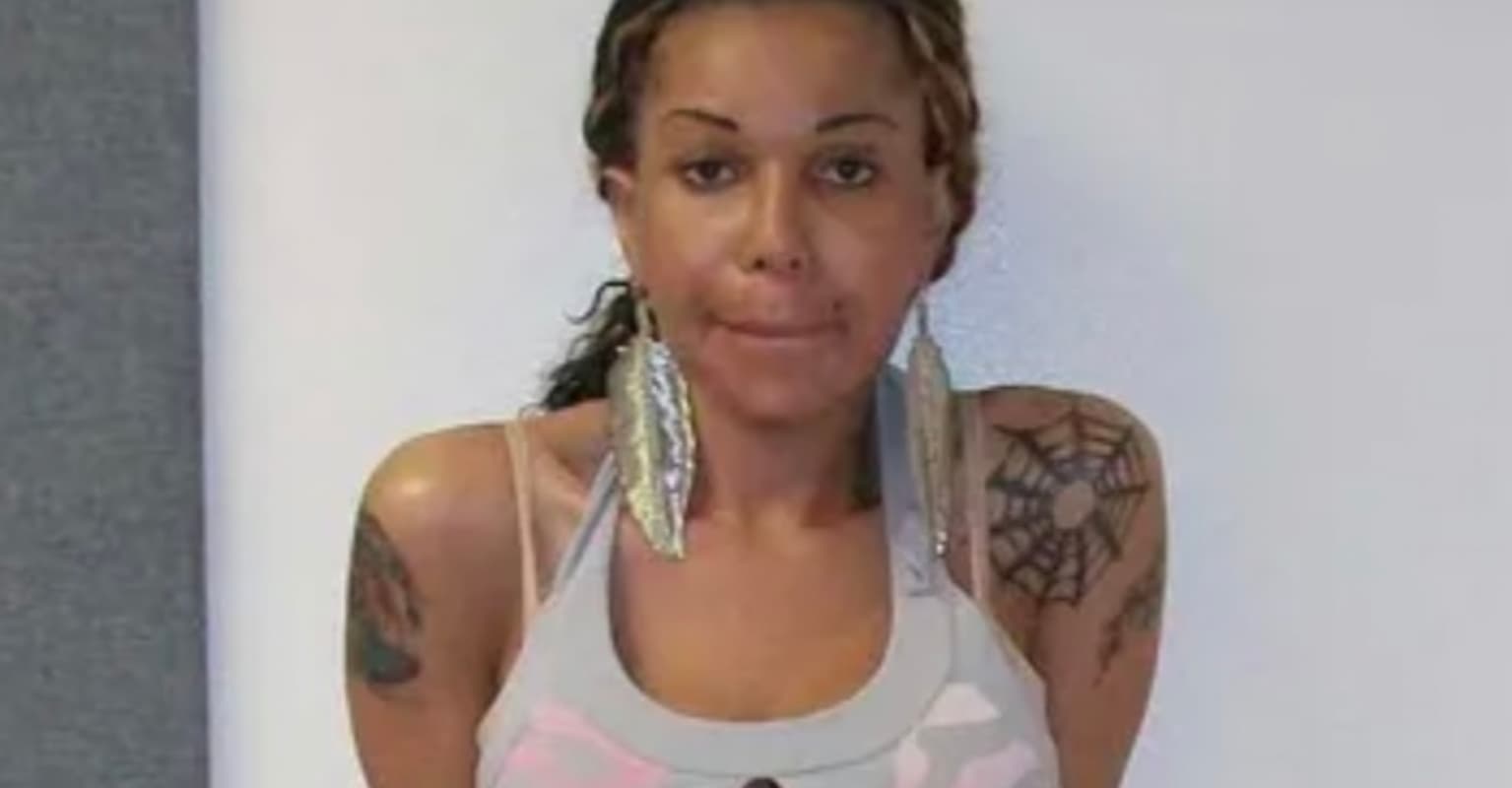 Fake doctor injected patients with tire sealant and cement to give them BBLs, leaving one dead